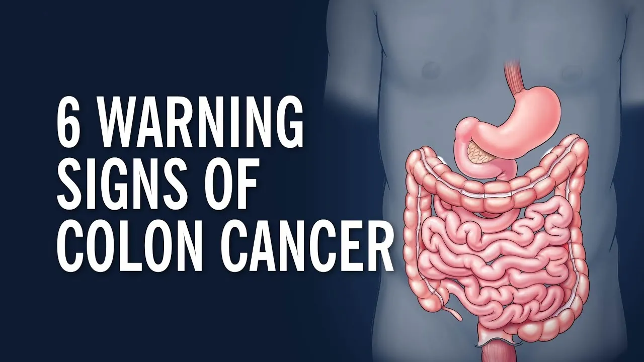 Σημαντική αύξηση καρκίνων του παχέος εντέρου και του ενδομητρίου